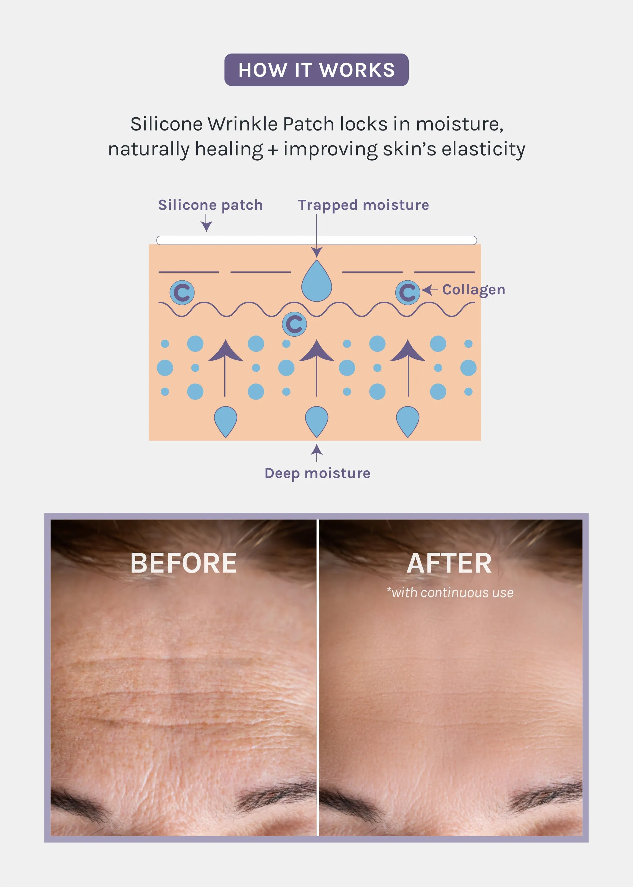 AOA Skin Wrinkle Smoothing Patch  Forehead
